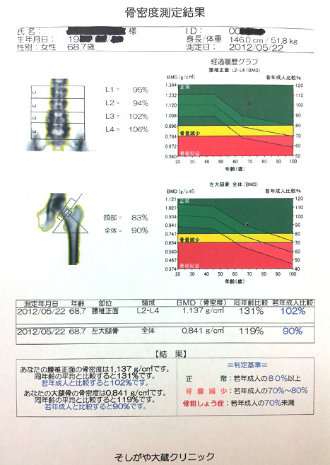 骨粗鬆症の検査